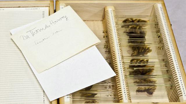 Potongan otak Albert Einstein