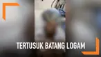 Kecelakaan mengerikan menimpa seorang pri berusia 21 tahun. Kepalanya  tertusuk batang logam hingga menembus ke sisi lainnya. Dokter berhasil mengeluarkan batang logam tersebut.