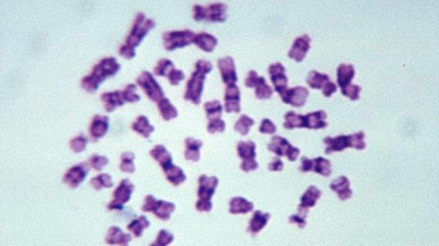 Ditemukan kromosom pria dalam kerangka Harper Road Woman