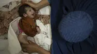 Sofia menggendong bayinya, Abdul (2 bulan), saat menjalani perawatan di bangsal gizi buruk Rumah Sakit Anak Indira Gandhi di Kabul, Selasa (5/10/2021). Petugas kesehatan di rumah sakit itu berlari mondar-mandir merawat bayi prematur dan yang lainnya menderita kekurangan gizi parah. (AP/Felipe Dana)