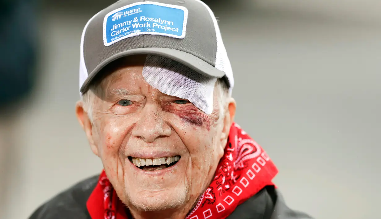 Mantan Presiden AS, Jimmy Carter menghadiri acara yang digelar Habitat for Humanity di Nashville, Tennessee, Senin (7/10/2019). Tampil di depan publik, mata kiri Carter memar dan mendapat beberapa jahitan di alis bagian atas setelah terjatuh di rumahnya pada Minggu waktu setempat. (AP/Mark Humphrey)