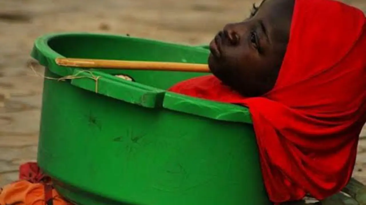 Kisah Mengharukan Gadis 'Ember Plastik' Tak Bertungkai di Nigeria
