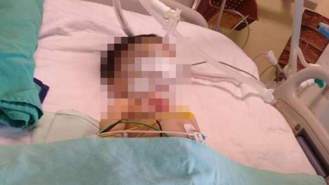 Babysitter Lalai, Nasib Balita yang Jatuh dari Ayunan Berakhir Memilukan