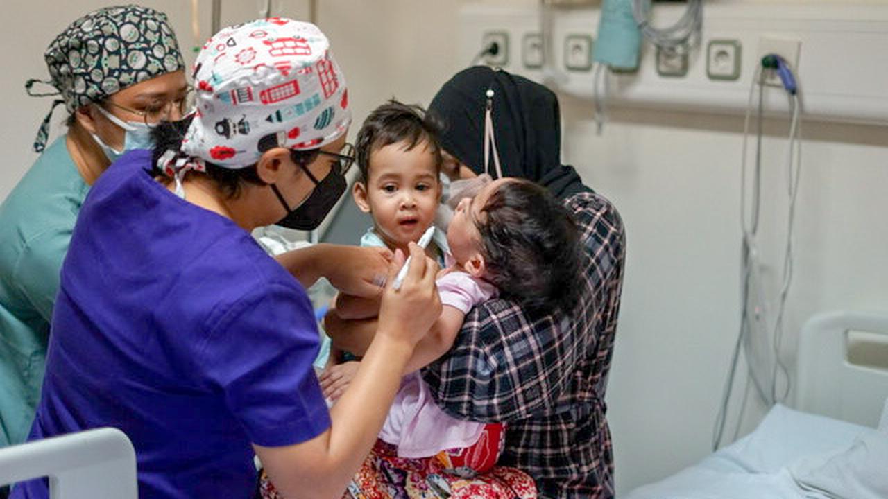 Bayi kembar siam asal Sukabumi