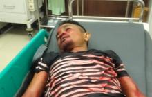 Ricuh di Tempat Karaoke saat Ramadan, Polisi Tewas Ditikam Preman