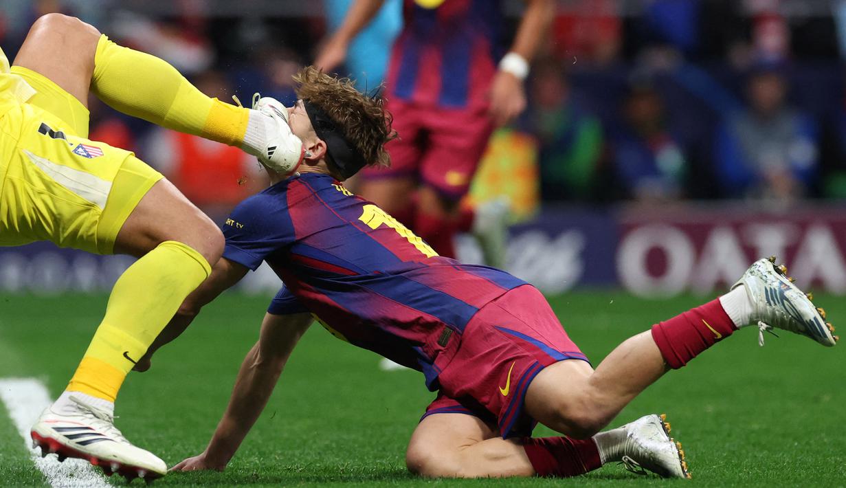 Benturan tersebut membuat Fermin Lopez mengalami luka robek serius di bagian wajah hingga mengeluarkan darah. (AFP/Javier Soriano)