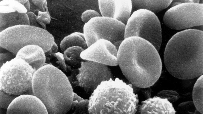 sel darah putih rendah