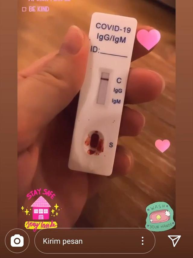 Celine Evangelista negatif virus corona Covid-19 (Insta Stories)