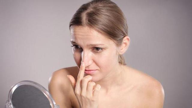 Malu Dong Punya Komedo? Hilangkan dengan Cara Ini Deh