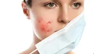 Tidak perlu langsung menambah banyak produk skincare. Rutinitas yang lembut dan kebiasaan menjaga kebersihan masker bisa menjadi langkah awal. (Foto/Dok: Magnific)