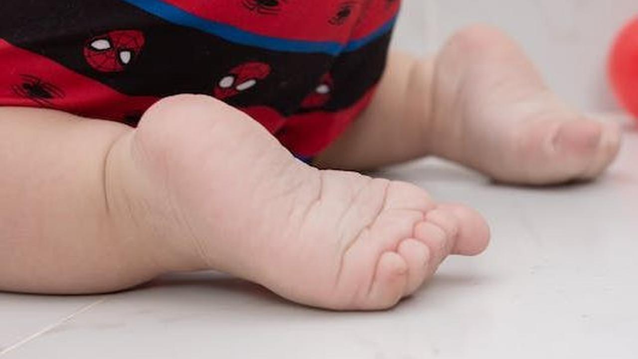 4. Pigeon Toes