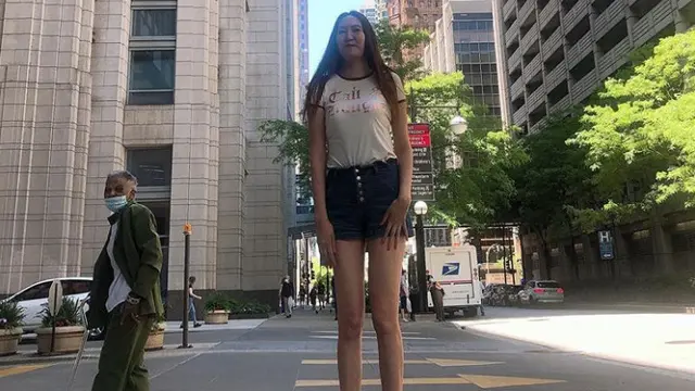 Miliki Tinggi 210 Cm, Gadis Ini Bangga dengan Kakinya yang Panjang