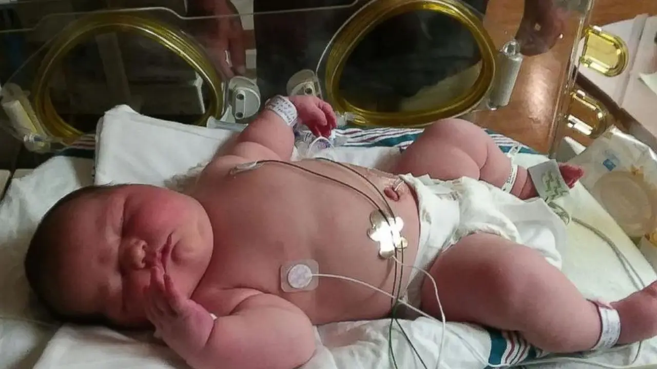 Lahirkan Bayi Seberat 6 Kilogram, Wanita Ini Kapok Punya Anak
