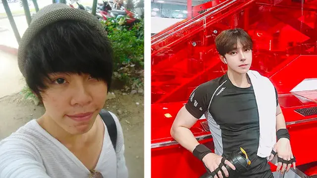 Ditolak Kerja karena Kurang Ganteng, Pria Nekat Operasi Plastik hingga Mirip Idol Kpop