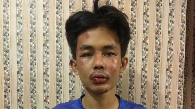 Polisi Pelaku Mengaku Spontan Menusuk Syekh Ali Jaber News Liputan6 Com