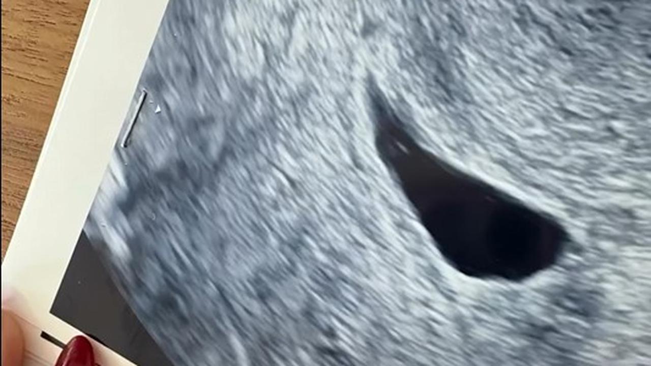 Nikita Willy keguguran (Instagram/nikitawillyofficial94)