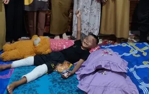 Siswa SD di Bandar Lampung Diduga Dibully hingga Patah Kaki