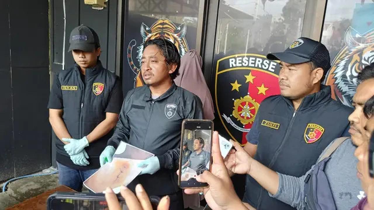 Gores Tangan dengan Silet dan Hantamkan Batu, Wanita Ini Rekayasa Begal demi Lepas dari Cicilan Motor