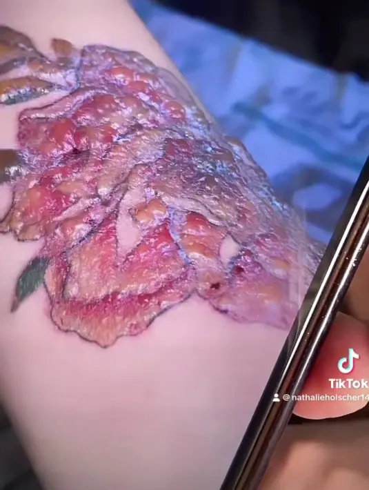 Nathalie Holscher membagikan hasil dari proses penghapusan tato bunga mawar tersebut melalui foto di ponselnya. Foto tersebut menunjukkan kulit Nathalie mengalami kemerahan dan melepuh di atas gambar tato bunga mawar. Selain itu, ia juga memperlihatkan tato di jari telunjuknya yang sudah mulai memudar usai 7 kali laser. (Liputan6.com/IG/@nathalieholscher)