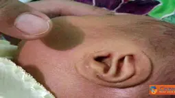 Tulisan Allah di Telinga Bayi
