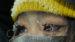 Es menggantung di bulu mata seorang operator kamera saat dia menyaksikan kualifikasi ski gaya bebas nomor mogul putra di Genting Snow Park selama Olimpiade Musim Dingin Beijing 2022 di Zhangjiakou, China, pada 3 Februari 2022. (AP Photo/Francisco Seco)