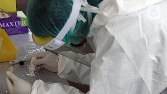 Ilustrasi diagnosa virus hendra