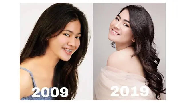 6 Potret Masa Remaja Felicya Angelista, Kini Genap 27 Tahun