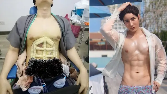 operasi six pack di Thailand