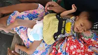 Badan Balita Ini Makin Hari Makin Menyusut