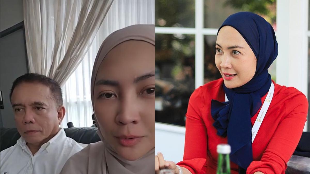 7 Potret Steffy Burase Eks Model Cerai dari Irwandi Yusuf, Awet Muda