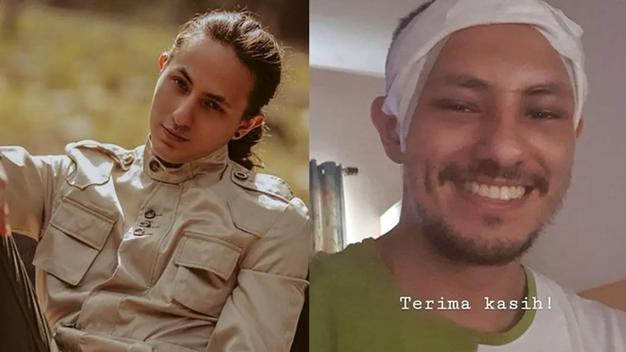 Potret Terbaru Dylan Carr Usai Kecelakaan