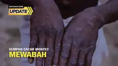 WHO menetapkan cacar monyet atau monkeypox sebagai Public Health Emergency of International Concern (PHEIC) atau darurat kesehatan global. Lalu, negara tetangga Singapura pun sudah ada 10 kasus. Meski sampai saat ini belum ada kasus, Ikatan Dokter In...