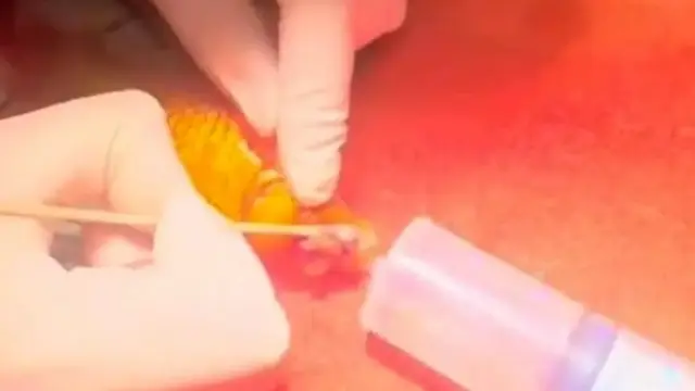 Tumor di Ikan Mas