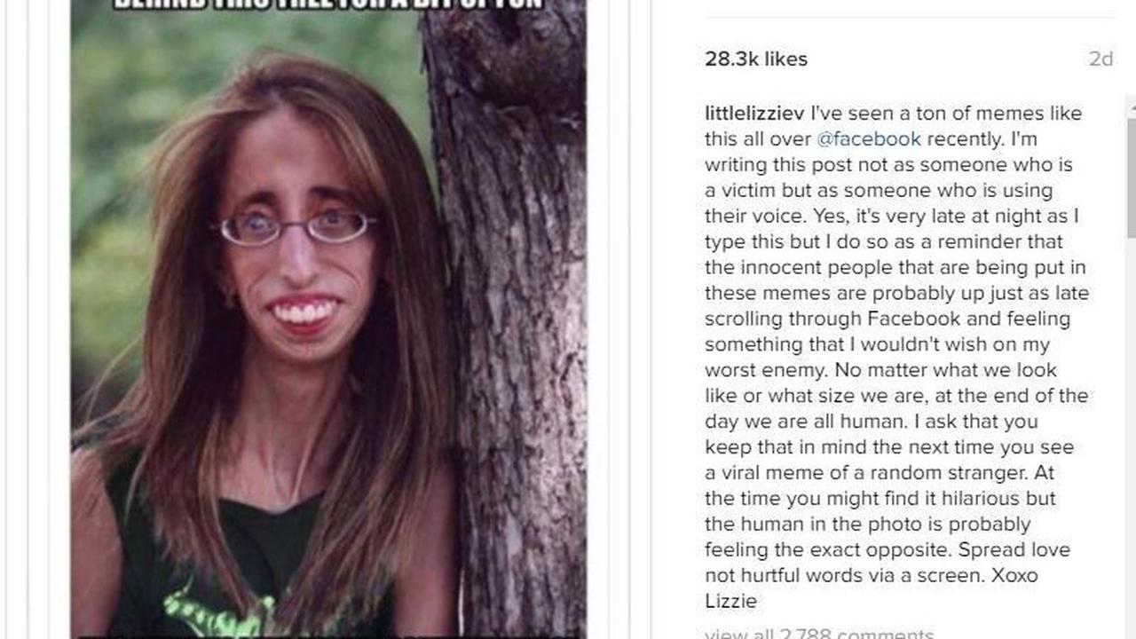 Idap Penyakit Langka, Wanita Ini Protes Fotonya Jadi Meme Guyon