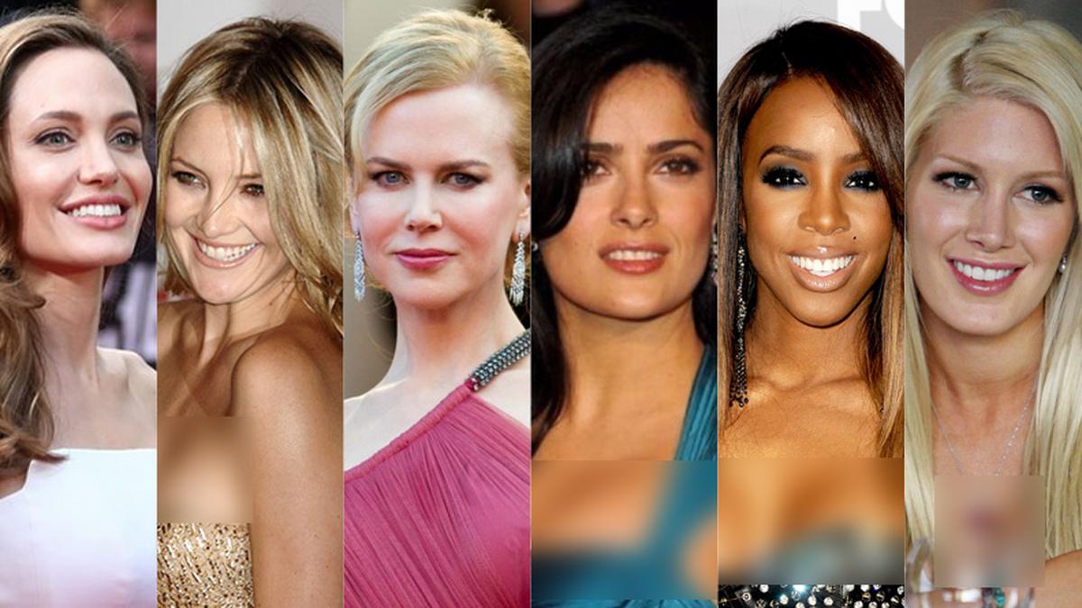 Daftar 10 Implan Payudara Termahal Artis Hollywood - ShowBiz Liputan6.com