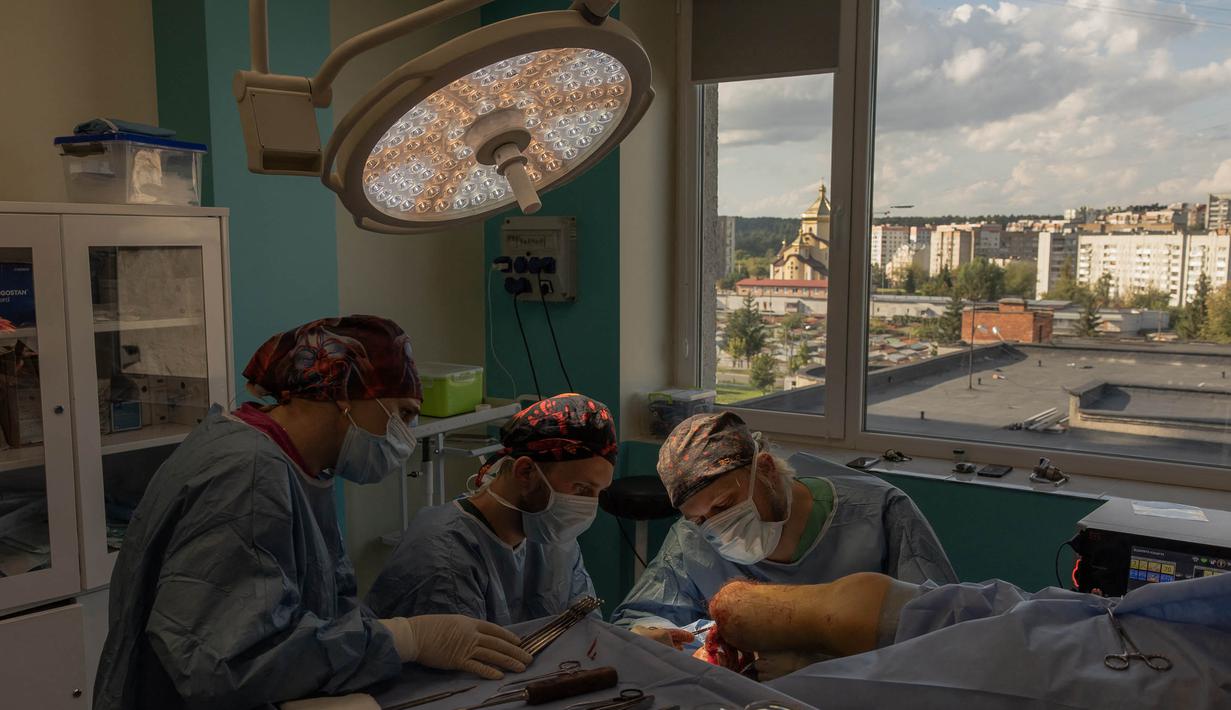 Para ahli bedah untuk Unbroken melakukan operasi pada kaki seorang tentara Ukraina dalam pertempuran di Soledar, distrik Bakhmut, di Pusat Rehabilitasi Nasional Unbroken di Lviv, Ukraina Barat, pada 18 September 2023, (Roman PILIPEY/AFP)
