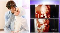 Lesty Kejora dan Rizky Billar ungkap wajah calon anak pertamanya. (Sumber: Instagram/lestykejora/YouTube/Indosiar)