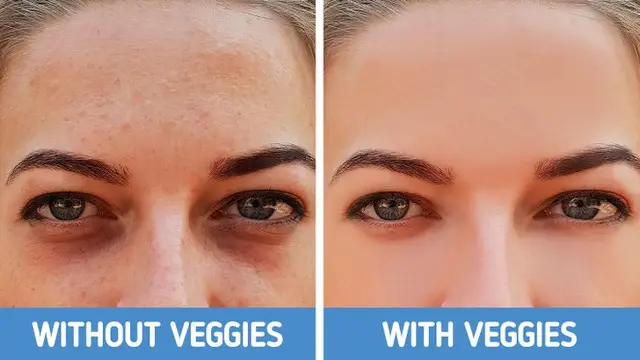 Warna kulit yang tidak merata dan lingkaran hitam pada mata/© Depositphotos.com,