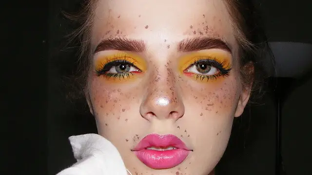 Eczema Tidak Sama dengan Jerawan dan Begini Cara Mengobatinya