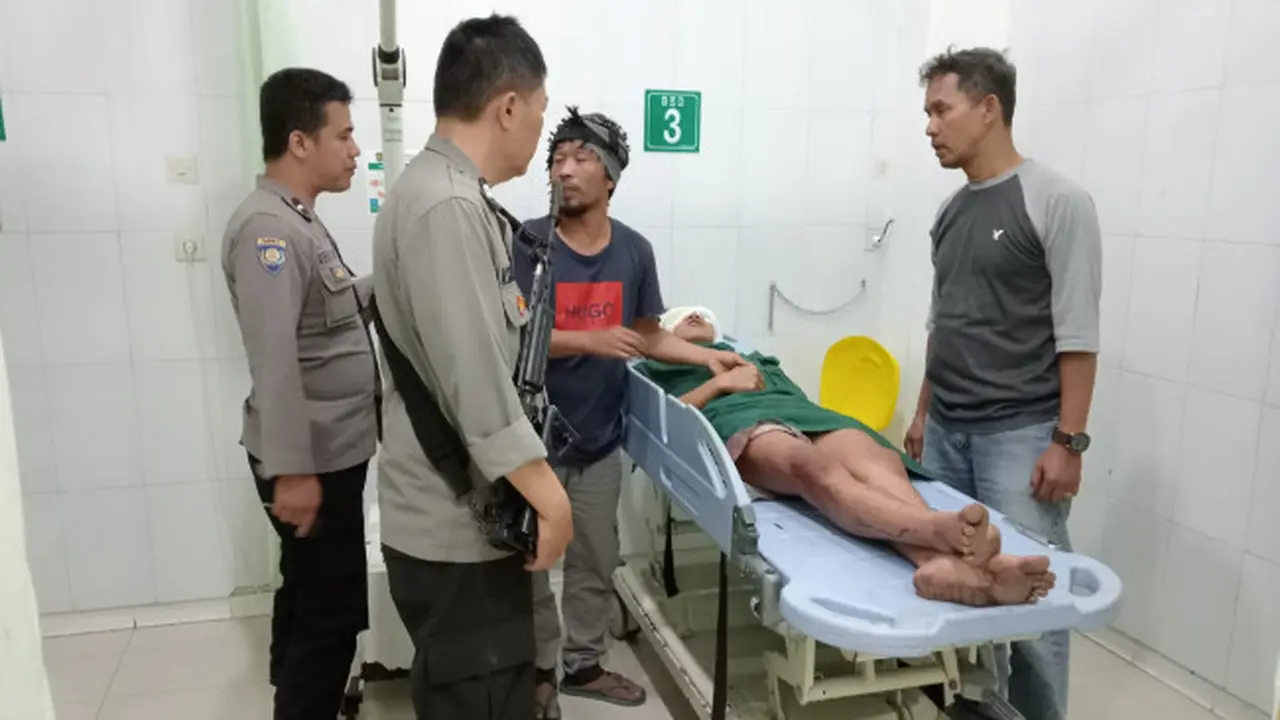 Geng Motor Kembali Berulah, Remaja di Purwakarta Luka Robek di Wajah Akibat Sabetan Sajam