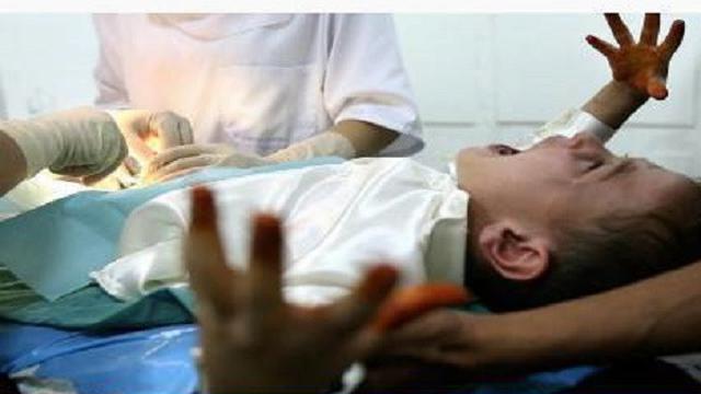 Sembunyikan Rasa Takut, 6 Ekspresi Anak Disunat Ini Bikin Ngakak