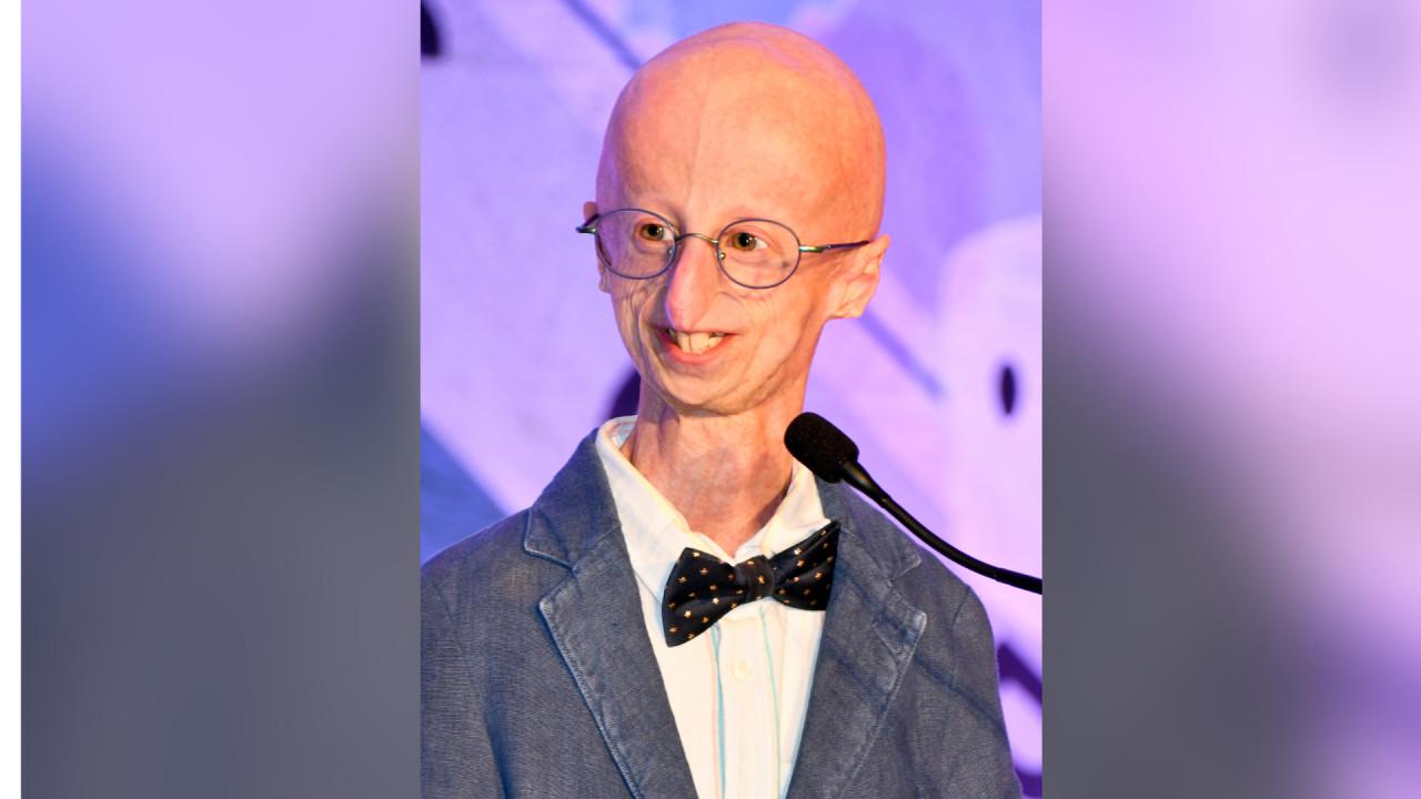 Sammy Basso tak hanya bertahan hidup dengan progeria, tapi juga berkontribusi dalam penelitian penyakit ini, menjadikannya sosok yang inspiratif. (doc: The Progeria Research Foundation)