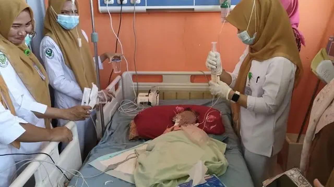 Update Balita di Bengkulu yang Heboh Keluarkan Cacing dari Mulut dan Hidung