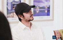 Kisah Arya Saloka Akui Wajahnya Sempat Rusak Karena Salah Penggunaan Obat, Peradangan Hingga Beruntusan