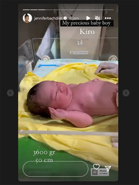 [Instagram/jenniferbachdim]