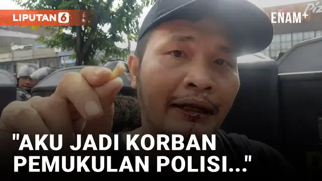 Nicho Silalahi Ngaku Dipukuli Polisi