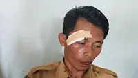 Fakta di Balik Video Viral Siswa SMP Aniaya Diduga Guru Hingga Berdarah