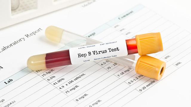 Cek di Sini Gejala Hepatitis