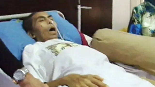 Hampir Sebulan Tata Dado Terbaring Lemah Tak Berdaya