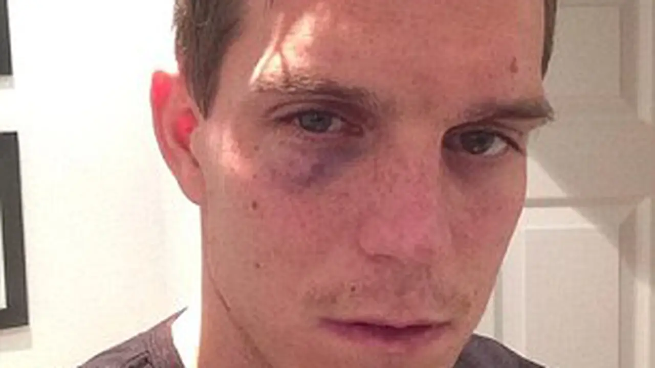 Daniel Agger